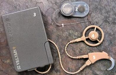 The entire cochlear implant system